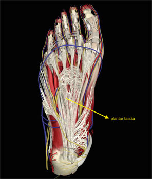 Heel pain - Plantar fascitis