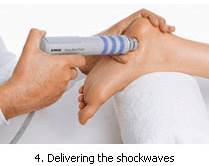 Extra Corporeal Shock Wave Therapy